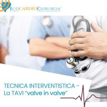 TECNICA INTERVENTISTICA -  La TAVI “valve in valve”