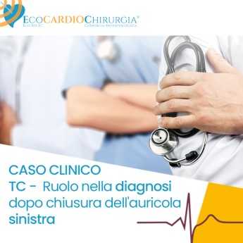 CASO CLINICO - TC. Ruolo nella diagnosi dopo chiusura dell'auricola sinistra