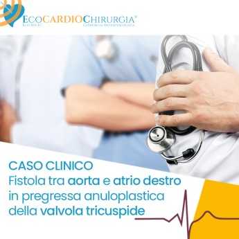 CASO CLINICO -  Fistola tra aorta e atrio destro in pregressa anuloplastica della valvola tricuspide