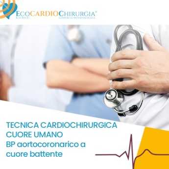 TECNICA CARDIOCHIRURGICA CUORE UMANO -  BP aortocoronarico a cuore battente