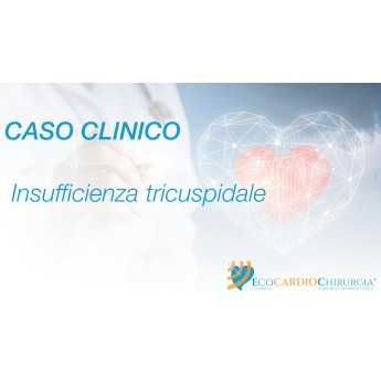 CASO CLINICO - Insufficienza tricuspidale