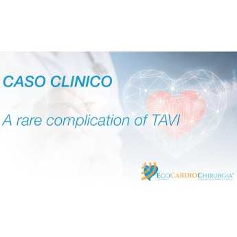 CASO CLINICO - TC - A rare complication of TAVI