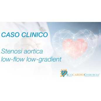 CASO CLINICO - SONOGRAPHER - Stenosi aortica low-flow low-gradient