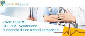CASO CLINICO - TC - FFR. Valutazione funzionale di una stenosi coronarica