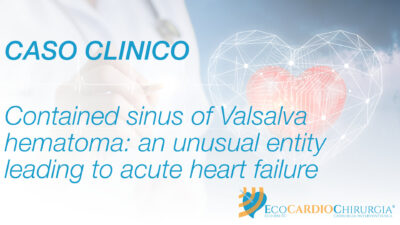 CASO CLINICO - TC - Contained sinus of Valsalva hematoma: an unusual entity leading to acute heart failure